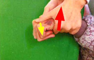 写真：手のこわばりをほぐす他動運動(1)