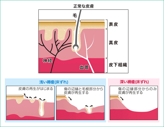 図2：皮膚が再生するしくみ