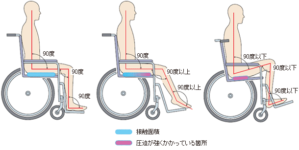 図：坐位での体圧分散