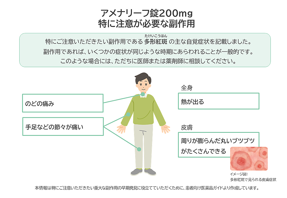 アメナリーフ錠200mgの特に注意が必要な副作用は多形紅斑です。手足などの節々が痛い、熱が出る、のどの痛み、皮ふに周りが膨らんだ丸いブツブツがたくさんできるなどがあらわれた場合は、ただちに医師または薬剤師に相談してください。