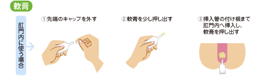 外用薬の使い方　軟膏 肛門内に使う場合