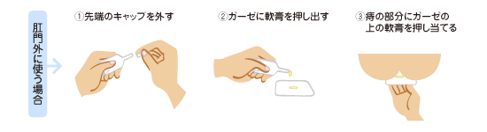 外用薬の使い方　軟膏 肛門外に使う場合