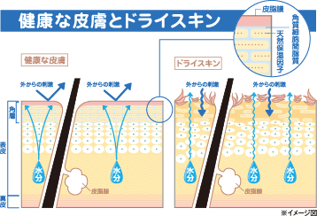 健康な皮膚とドライスキン