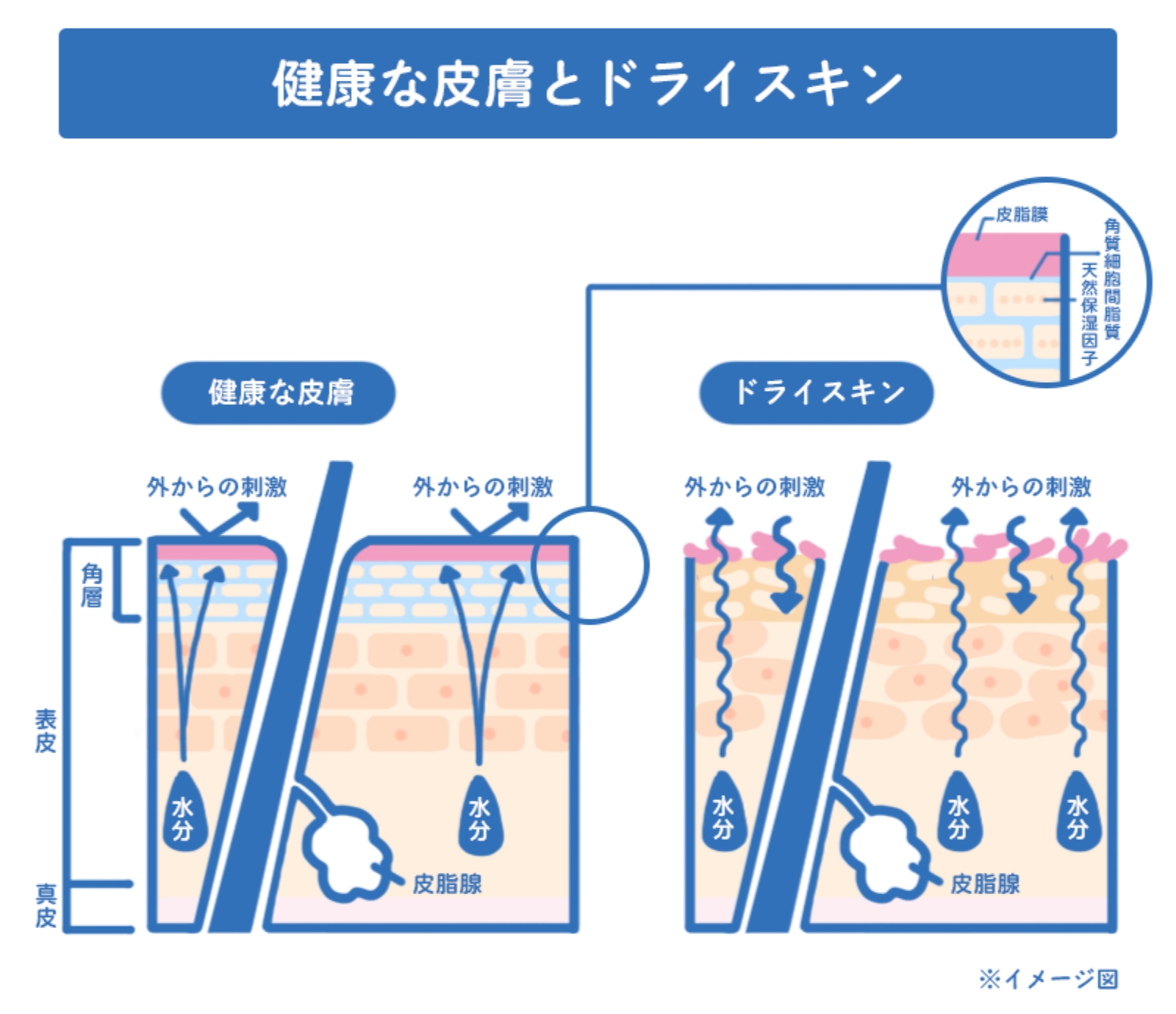 健康な皮膚とドライスキン