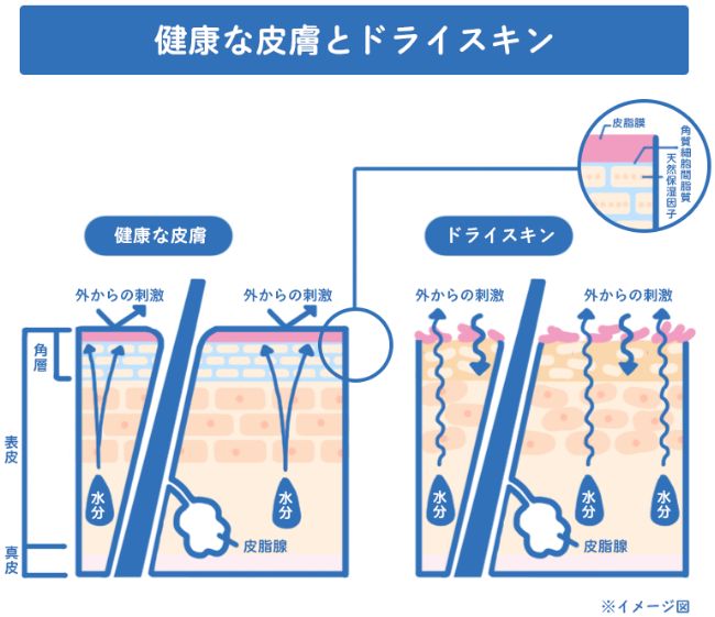 健康な皮膚とドライスキン