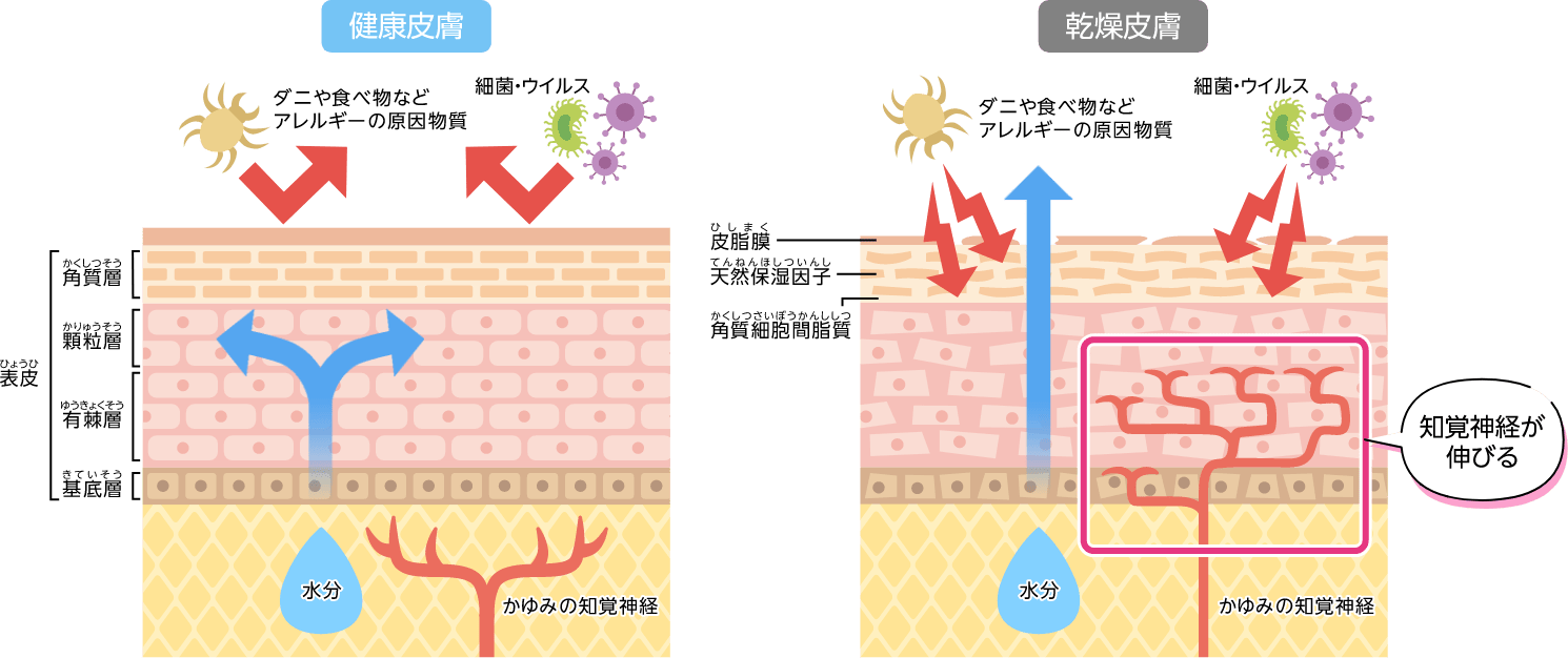 健康皮膚と乾燥皮膚