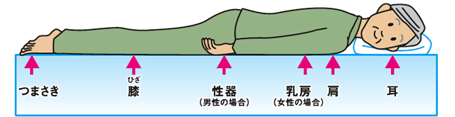 褥瘡(じょくそう・床ずれ)ができやすいところ：うつぶせの場合 