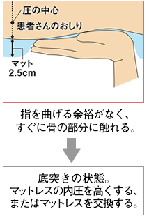 指を曲げる余裕がなく、すぐに骨の部分に触れる→底突きの状態。