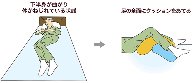 下半身が曲がり体がねじれている状態→足の裏側全面にクッションをあてる