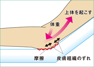 図：摩擦やずれによる力のかかり方