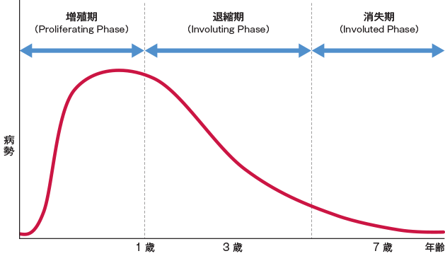 乳児血管腫（いちご状血管腫）の経過