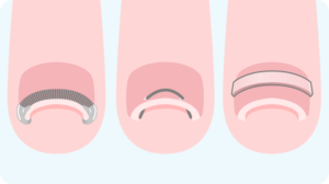 覚えておきたい 正しい爪の切り方 巻き爪 陥入爪専門メディア 巻き爪を知る 治す 予防する 製薬会社のマルホ