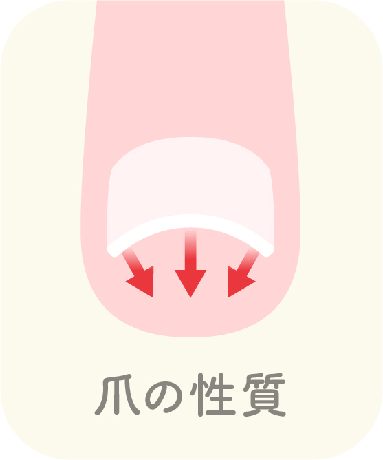 巻き爪ケース2 爪の性質