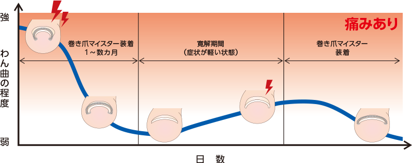 治療期間の目安