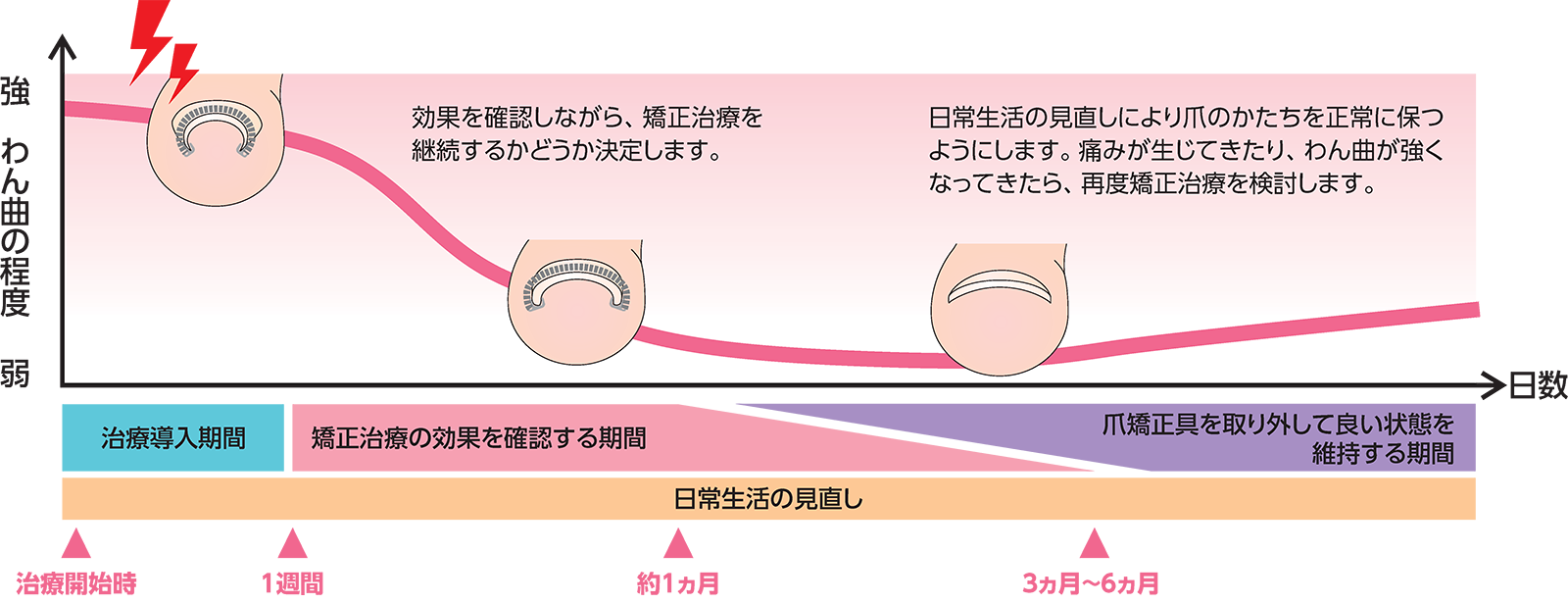 治療期間の目安