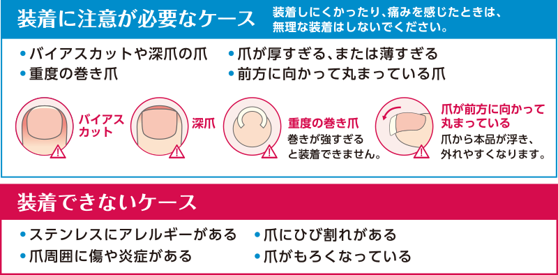 装着に注意が必要なケース、装着できないケース