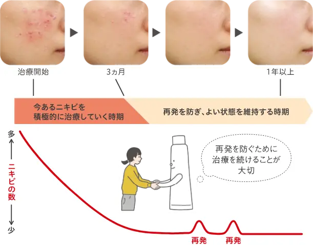 治療を続けたときのイメージ