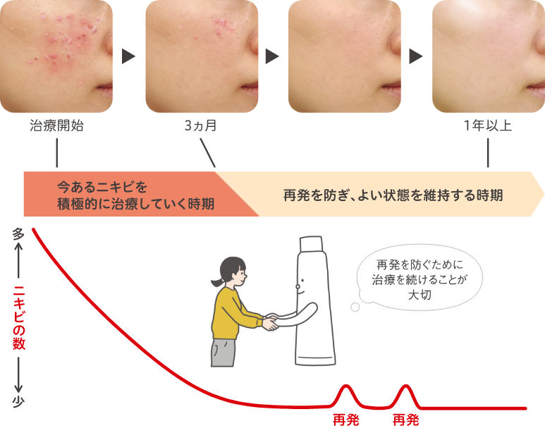 ニキビではないとき