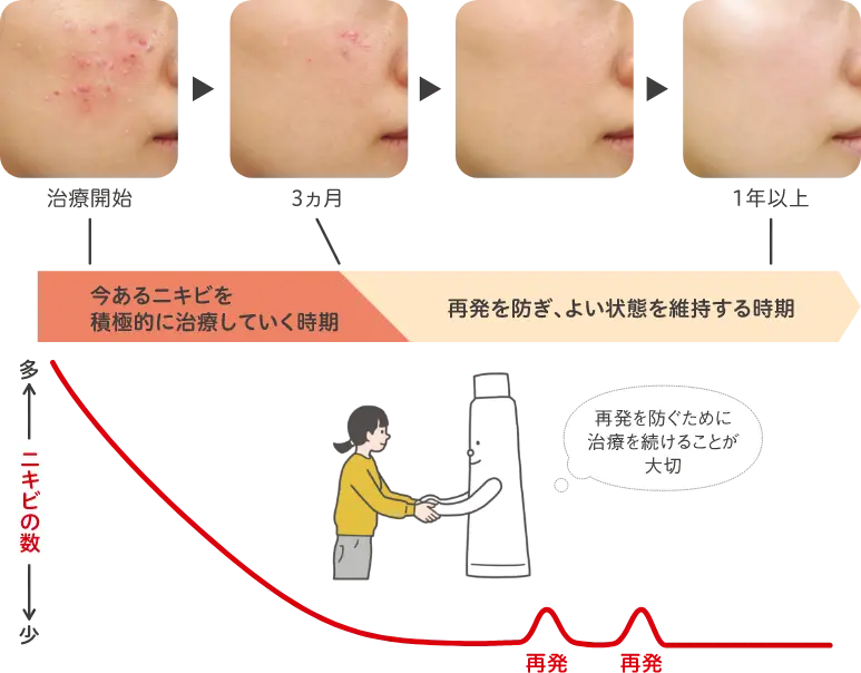 コメド治療を続けることで目指せる肌