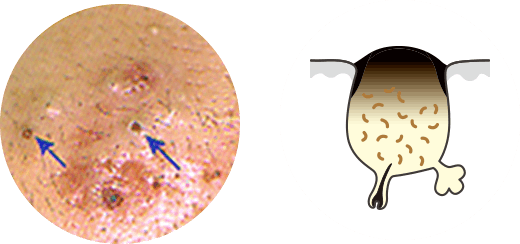 原因と危険因子