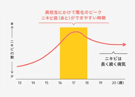 高校生にかけて悪化のピーク。ニキビ痕ができやすい時期