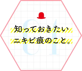 知っておきたいニキビ痕のこと。