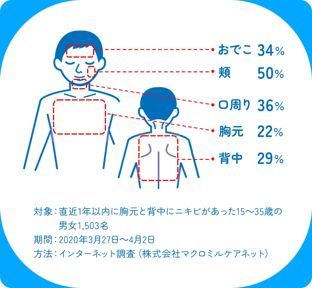 おでこ 34%、頬 50％、口周り 36％、胸元 22％、背中 29％