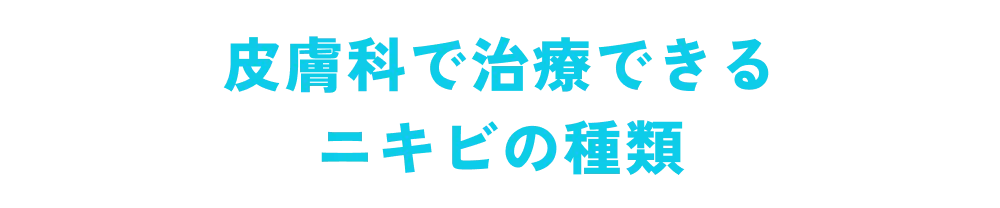 皮膚科で治療できるニキビの種類