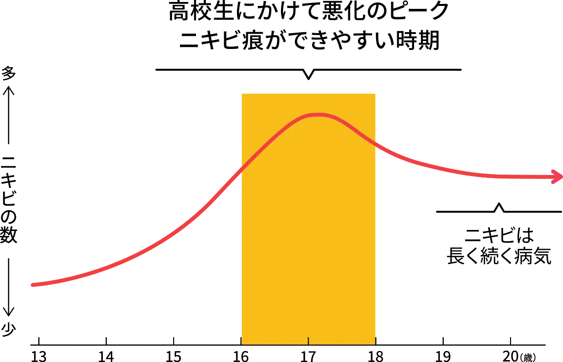 高校生にかけて悪化のピーク ニキビ跡が出来やすい時期