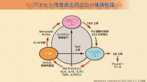 動面とスライドによる解説