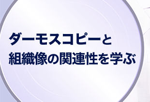 ダーモスコープと組織像の関連性を学ぶ