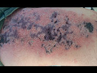 Nassim Idouraine, MD. 提供<br />無断複写・転載禁止