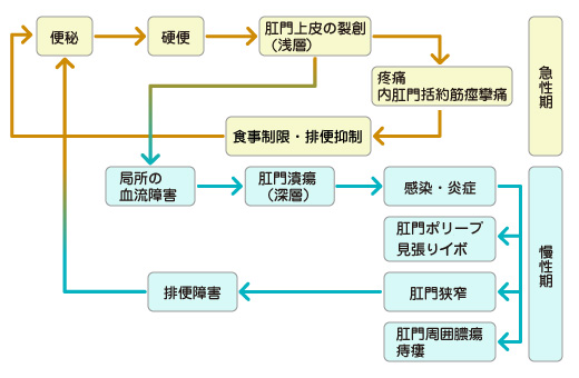 裂肛の発生と経過