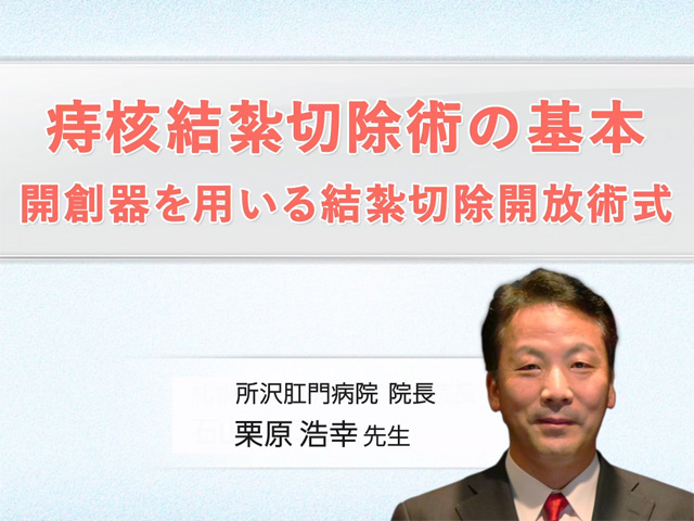 痔核結紮切除術の基本