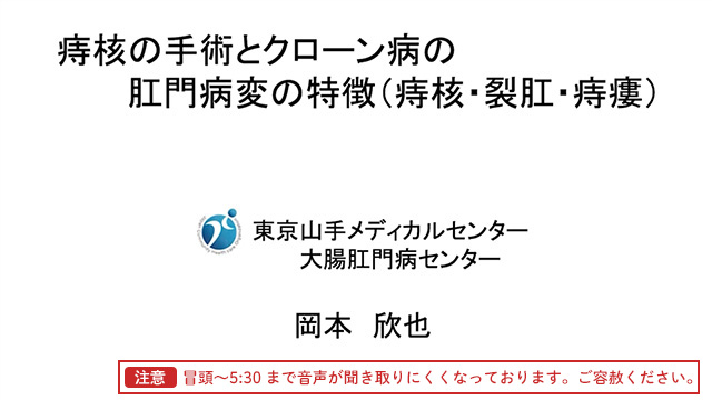 痔核の手術とクローン病の肛門病変の特徴（痔核・裂肛・痔瘻）