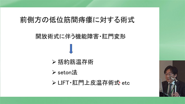 前側方の低位筋間痔瘻に対する術式 開放術式に伴う機能障害・肛門変形