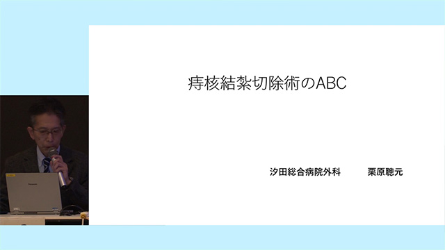 痔核結紮切除術のABC