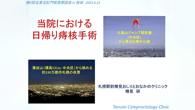 当院における日帰り痔核手術