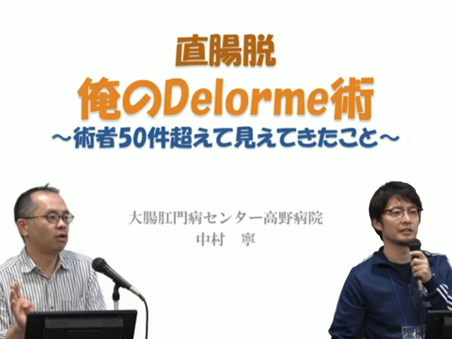 直腸脱　俺のDelorme術　～術者50件超えて見えてきたこと～