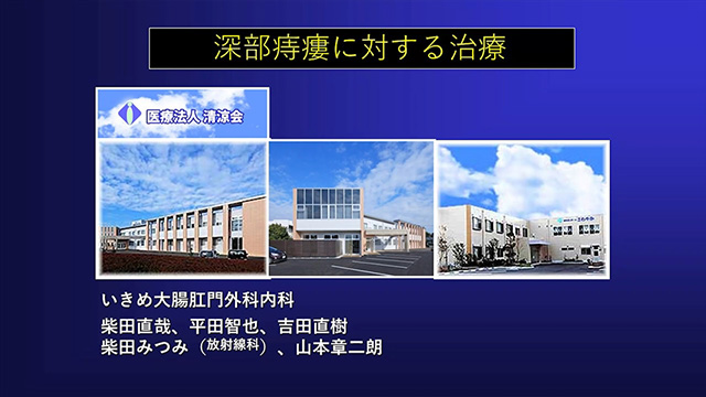 深部痔瘻に対する治療
