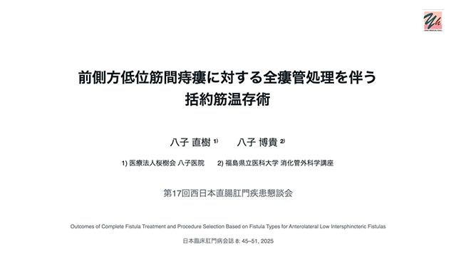 前側方低位筋間痔瘻に対する全瘻管処理を伴う括約筋温存術