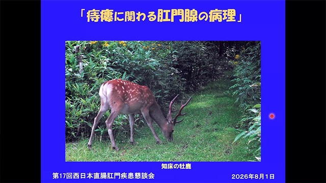 痔瘻に関わる肛門腺の病理