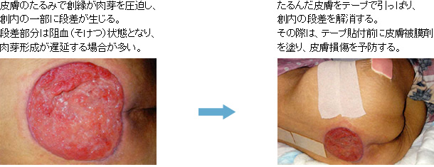 図：テープの使用