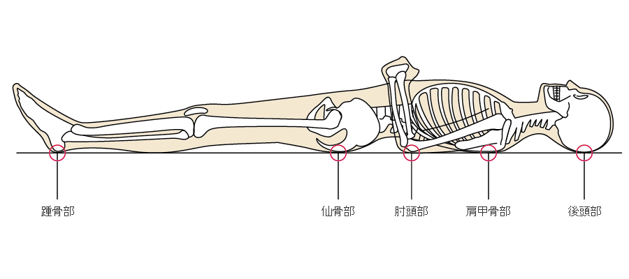 褥瘡のメカニズム 褥瘡辞典 For Medical Professional 医療関係者向け情報 マルホ株式会社