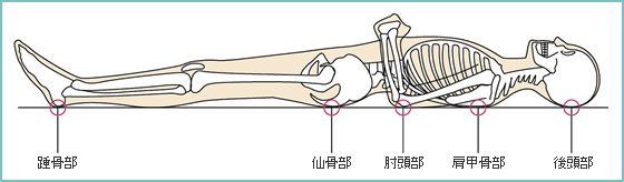 仰臥位