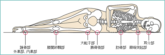 側臥位