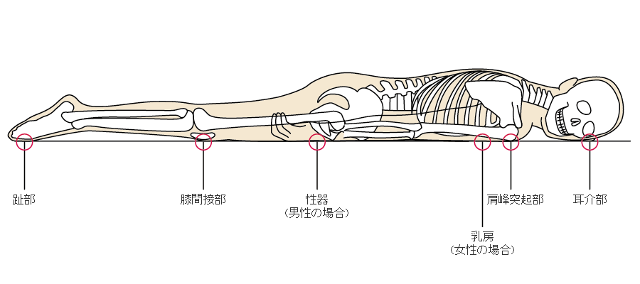 褥瘡のメカニズム 褥瘡辞典 For Medical Professional 医療関係者向け情報 マルホ株式会社