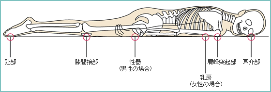 褥瘡のメカニズム 褥瘡辞典 For Medical Professional 医療関係者向け情報 マルホ株式会社