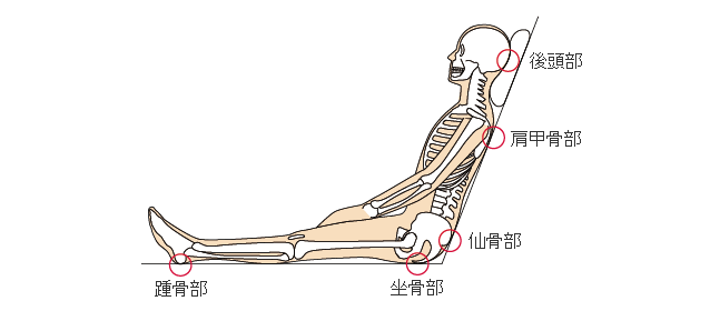 褥瘡のメカニズム 褥瘡辞典 For Medical Professional 医療関係者向け情報 マルホ株式会社