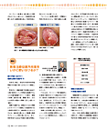 創傷治癒促進外用薬をいかに使い分けるか？